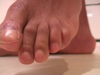 Black Foot Fetish - Extreme Male Toes Black Foot Fetish - Extreme Male Toes